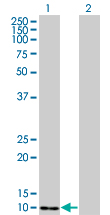 WB - S100A4 Antibody (monoclonal) (M01) AT3757a
